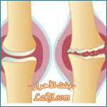 افتراضي هل انهيتي الـ 35 من عمرك ؟ ღღ هل لديكِ مشاكل بالمفاصل؟ - انتي محور حديثنا أهلا بكِ  Winter_MfaselPIC2