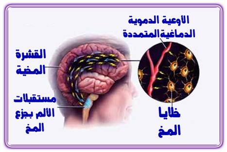 علاجات طبيعيه للصداع النصفى AmSalah_image020