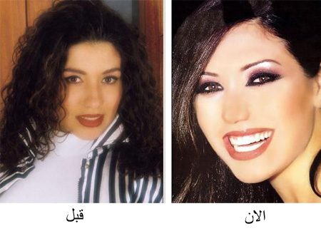 صور للفنانات قبل و بعد 36709