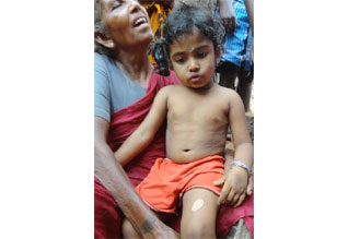 அழுகையை நிறுத்த சிறுமிக்கு சூடு: அங்கன்வாடி பணியாளர்கள் சஸ்பெண்ட் Tamil_News_large_504959