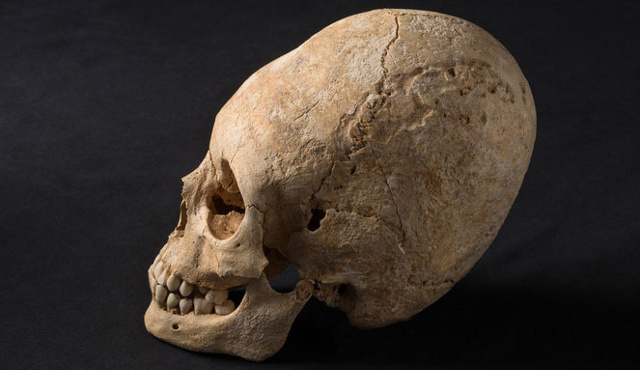 French Archaeologists Discover Beautifully Preserved Deformed Skull Ku-xlarge