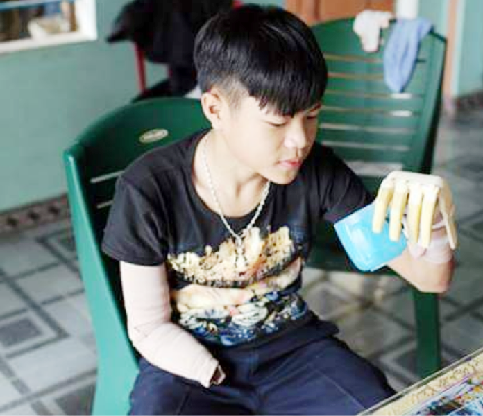 Hợp tác, chia sẻ nguồn nhân lực điều dưỡng người cao tuổi giữa Việt Nam và Nhật Bản Robot02