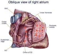 Atrial Flutter  150072-1332317-151210-1425780tn