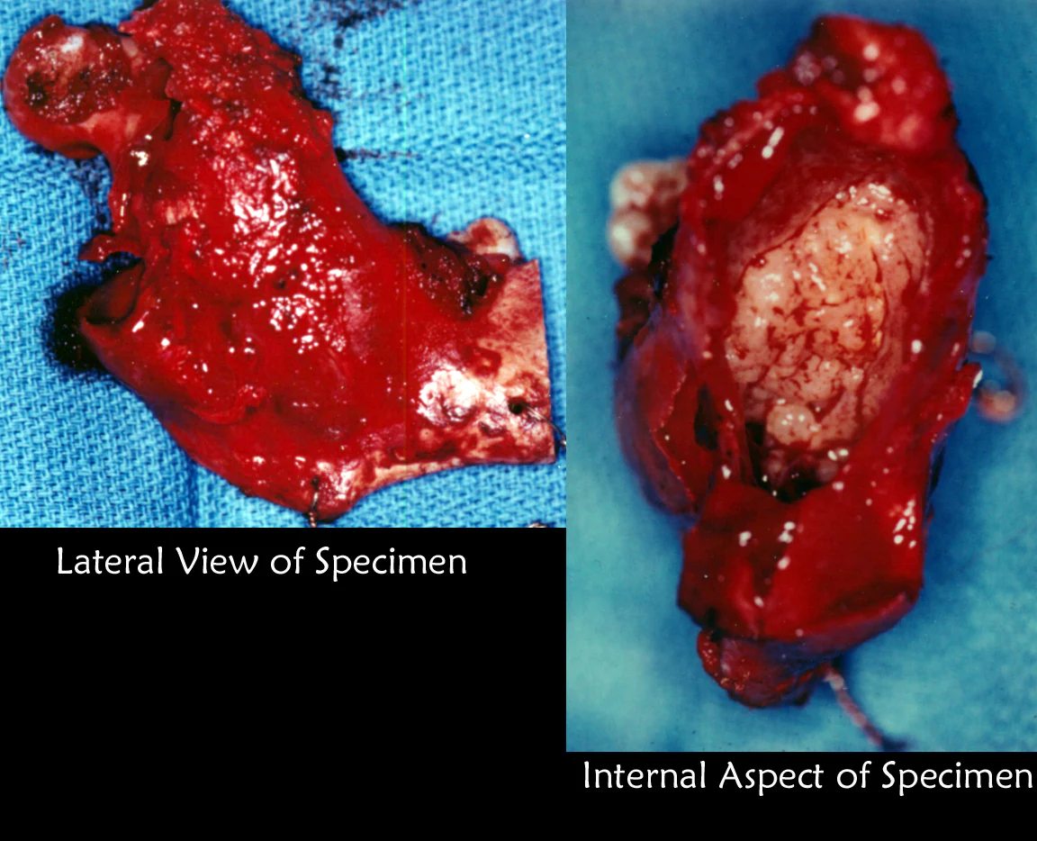 Odontogenic Cysts and tumors without link 834279-852734-88