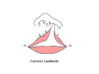 Craniofacial, Unilateral Cleft Lip Repair  1271089-1279641-708tn