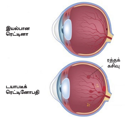 டயாபடீஸ் ரகசியங்களும்... தீர்வும்... கம்ப்ளீட் கைடு P101a(1)