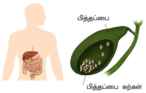 டயாபடீஸ் ரகசியங்களும்... தீர்வும்... கம்ப்ளீட் கைடு P76a(1)