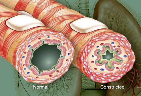 A Visual Guide to complete Asthma Cure Princ_rm_photo_of_airway_illustration