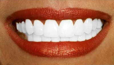 Comment blanchir les dents naturellement ? Dents-blanches-2387972601_1-224de4a