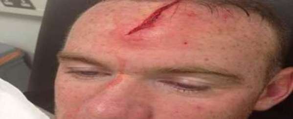 Wayne Rooney tiene una aparatosa cicatriz en la cabeza Rooney-ha-colgado-esta-fotogra_54381017410_54115221155_600_244