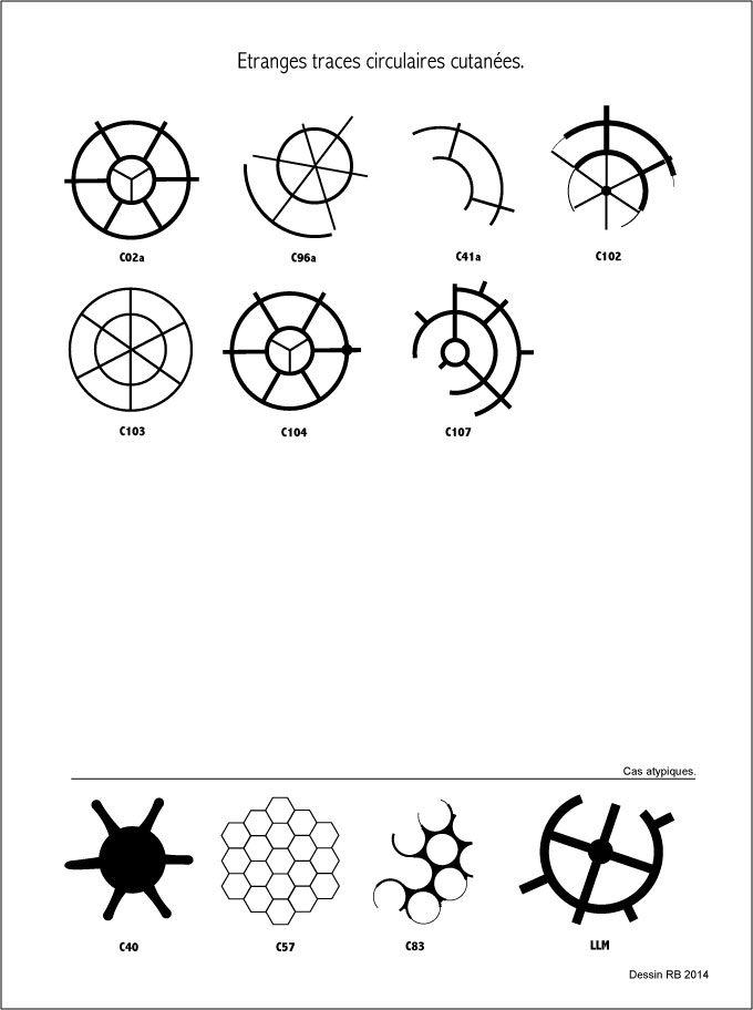 Étranges traces circulaires cutanées.  - Page 3 Les-cas-04-46a6a79