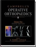 Campbell's Operative Orthopaedics, Four Volume Set Th_52963_campot_122_668lo