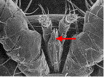 LE VARROA des ABEILLES  Varrost