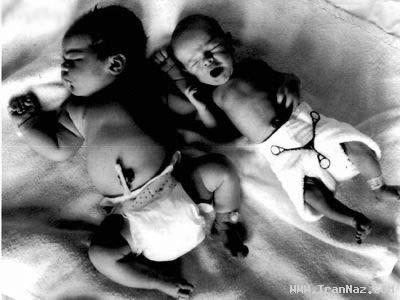 بزرگ ترین و سنگین ترین کودکان متولد شده + تصویر 0.516052001313860171_irannaz_com