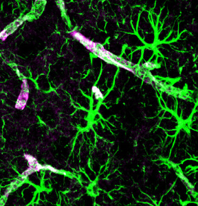 The Remarkable Language of Cells Astrocytes-PUBLIC-DOMAIN--288x300