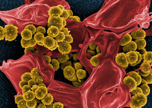 The Remarkable Language of Cells Jacopo-Werther-WIK-BEAUTIFUL-800px-Scanning_electron_micrograph_of_Methicillin-resistant_Staphylococcus_aureus_MRSA_and_a_dead_Human_neutrophil_-_NIAID-300x214