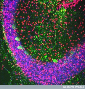 The Remarkable Language of Cells WC-colorful-cerebellum-neurons--287x300