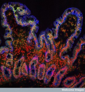 The Remarkable Language of Cells Wellcome-villi--276x300