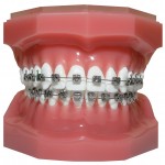 كتيب عن  كل ما يتعلق بالاسنان Std-metal_braces-150x150