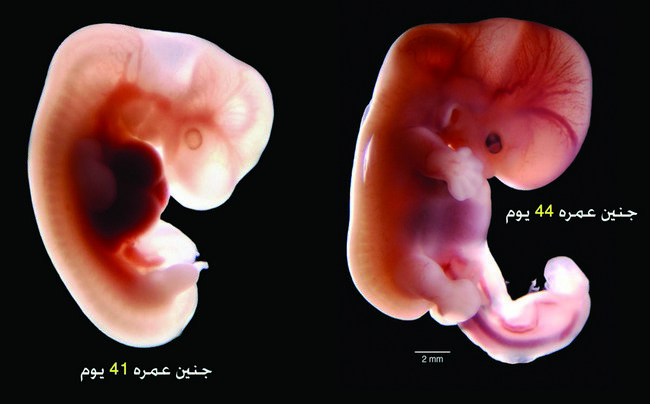 إذا مرَّ بالنطفة ثنتان وأربعون ليلة.. معجزة نبوية ترد على الملحدين 111(4)