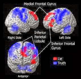 C’est prouvé scientifiquement : Le devant de la tête ment ! Lie-detector-fmri