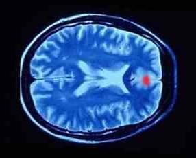  الناصية بين العلم والإيمان  Brain-22