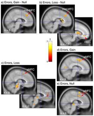 الناصية هي مركز الكذب قال تعالى ( ناصية كاذبة خاطئة )  Brain-44