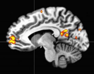 الشفاء بالقرآن Brainscan3-300x237