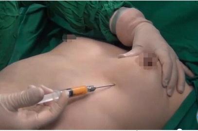 Phương pháp nâng ngực không cần phẫu thuật Nang_nguc_khong_can_phau_thuat_3