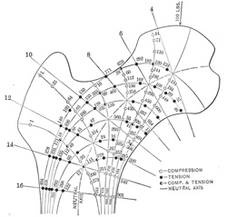 anatomy of femur تشريح عظم الفخذ 251