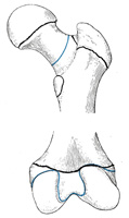 anatomy of femur تشريح عظم الفخذ 254