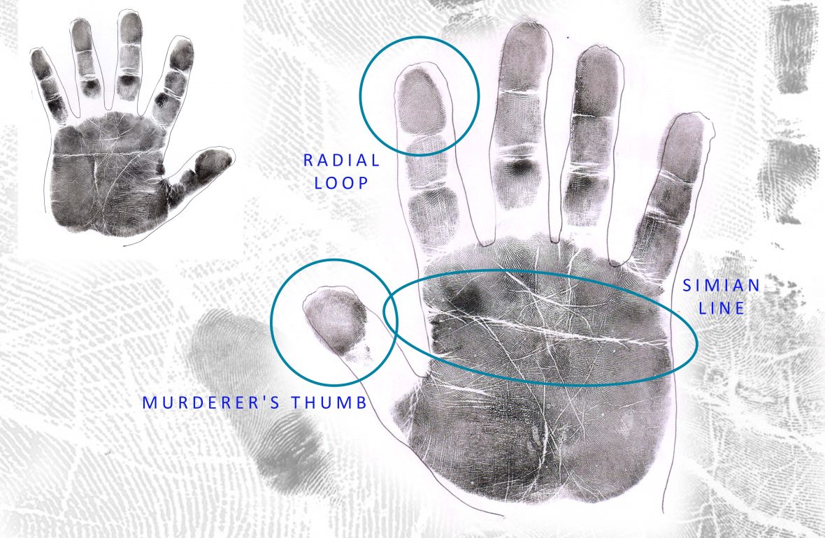 THE MOST CHALLENGING HAND: Simian Lines, Murderer’s Thumbs & Radial loops The-Most-Challenging-Hand-1180x770