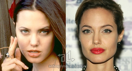 ARREPENTIDA DE LA CIRUGIA ESTÉTICA - Página 3 Angelina_jolie_antes_y_despues_cirugia