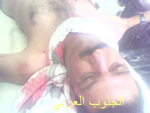 مجزرة جديدة ترتكبها قوات أحتلال صنعاء في الجنوب IMG2199A