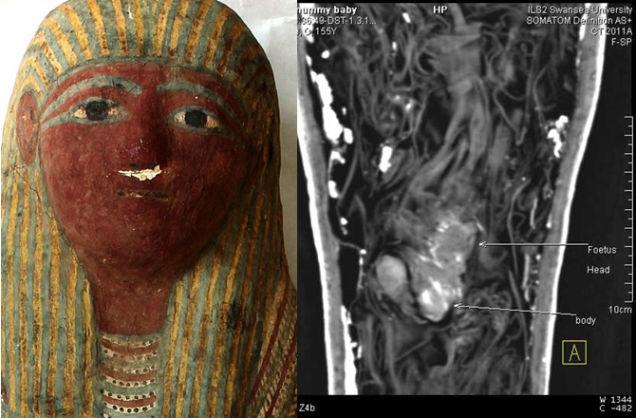 Ancient Egyptian Mummy Determined to be Unborn Baby at 12-16 Mummyfetus