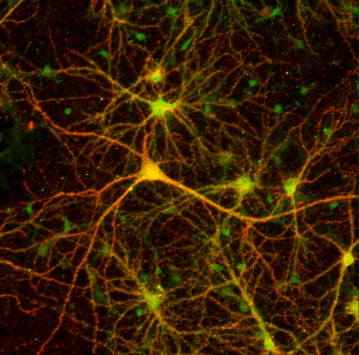 Qu'est-ce que l'algorithme de rétro-propagation du gradient de l'erreur dans un perceptron multi-couche rebouclé sur lui-même ? Photo-neuron345