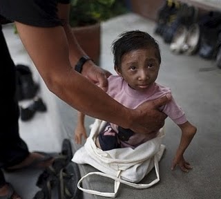 اصغر رجل في العالم يعيش في نيبال 470