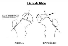 Ortopedia pediátrica Images