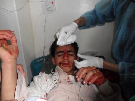الى من اراد الحقيقه عن المظاهرات والقتل وكل ما يحدث في اليمن حالياً (الوجهه الحقيقي) 15555552