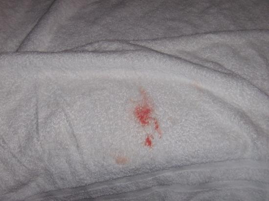 ...................hey Peanut A-blood-stained-towel