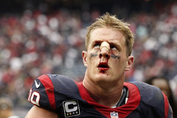 The  Never-Ending Thread - Page 17 JJ-Watt-bloody-nose_132535