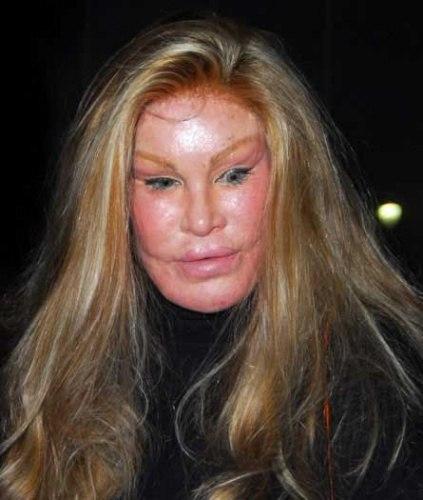 les ravages de la chirurgie esthtique Jocelyn-wildenstein-dangers-chirurgie-esth233-L-1