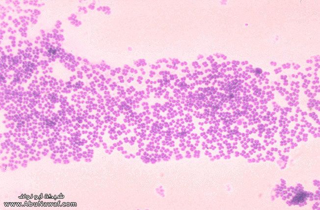 البكتريا Micrococcus