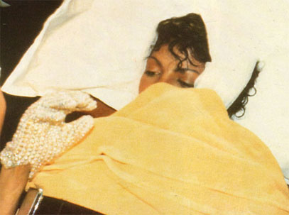  صورة لجثة مايكل جاكسون تكشف أسرار حياته MJ-Pepsi-burn-yellow