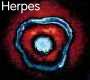 Big Pharma and the Medical Health Industry - Page 4 Herpes10