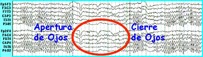 Hablemos de cerebros AperturayCierreOjos
