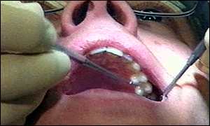 نصيحة طبية: أسنان العقل ضرورية _689856_equipmentingob300