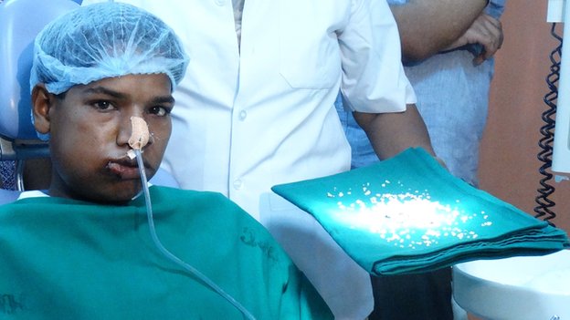 India doctors remove 232 teeth from boy's mouth _76474804_468f8227-7f85-4ff4-9b83-f4ab5b16277a