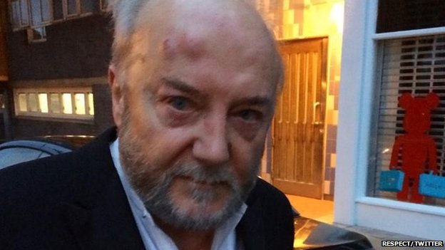 LOL, UK's MP George Galloway taken to hospital after street attack _77271144_77271143