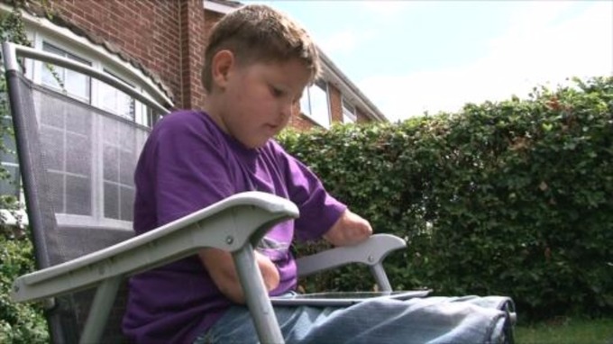 Boy with no arms or legs told he must prove he is disabled to keep benefits Stream_img